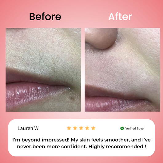 Primrose – Nicor™  Facial Hair Removal Kit