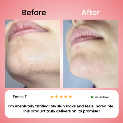 Primrose – Nicor™  Facial Hair Removal Kit
