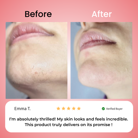 Primrose – Nicor™  Facial Hair Removal Kit