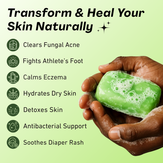 Primrose™ AntiFungal Relief Soap Bar