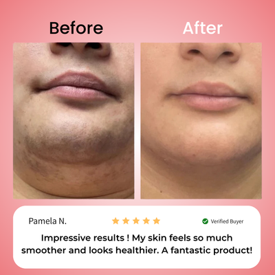 Primrose – Nicor™  Facial Hair Removal Kit