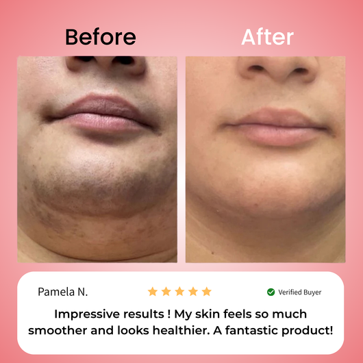 Primrose – Nicor™  Facial Hair Removal Kit