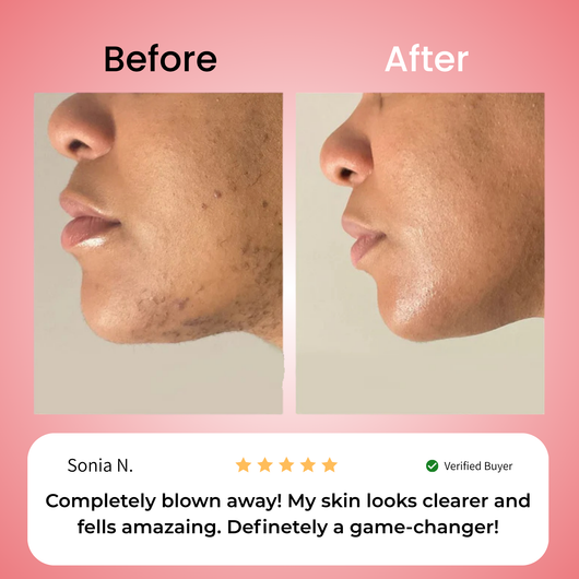 Primrose – Nicor™  Facial Hair Removal Kit