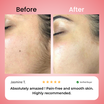 Primrose – Nicor™  Facial Hair Removal Kit