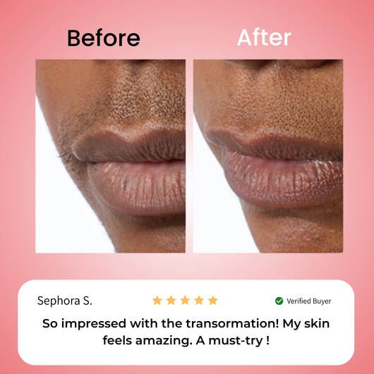 Primrose – Nicor™  Facial Hair Removal Kit