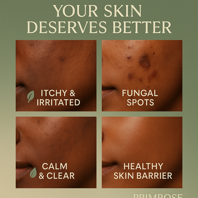 Primrose™ Tea Tree Oil Acne Cream