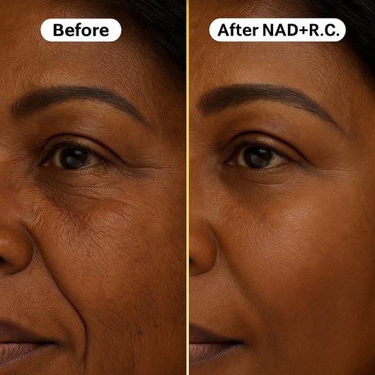 Primrose™ NAD+ Reversal Complex