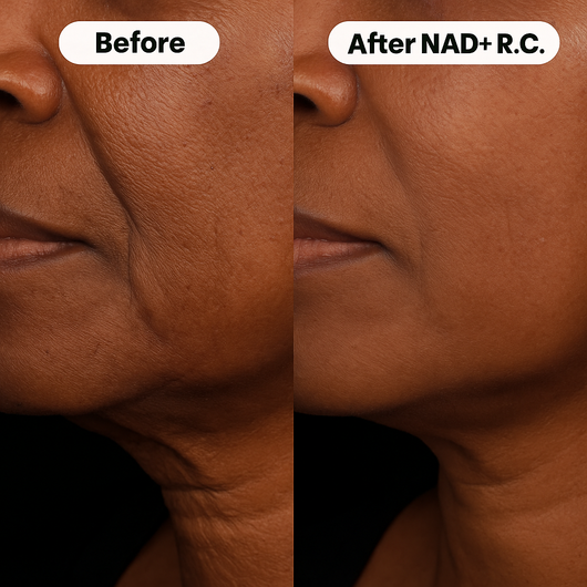Primrose™ NAD+ Reversal Complex