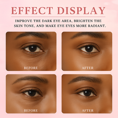 Primrose™ – Eye Renewal Massage Cream