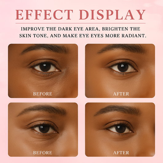 Primrose™ – Eye Renewal Massage Cream