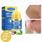Urea Foot Care Stick  – Repairs Cracked and Dry Feet