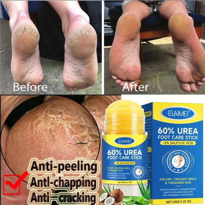 Urea Foot Care Stick  – Repairs Cracked and Dry Feet