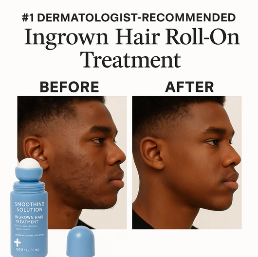 Smoothing Solution Ingrown Hair Treatment