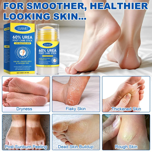 Urea Foot Care Stick  – Repairs Cracked and Dry Feet
