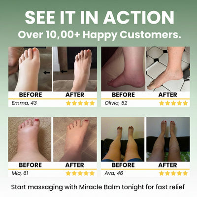 Primrose™ Miracle Balm Swelling Relief