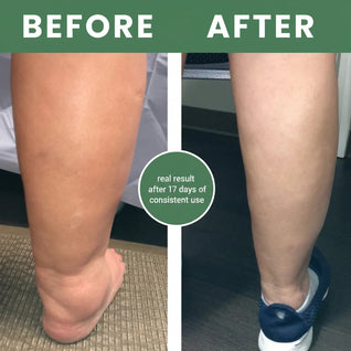 Primrose™ Miracle Balm Swelling Relief